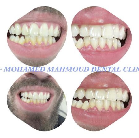 Dr. Mohamed Mahmoud Dental Clinic
