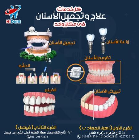 HiDent Dental Clinic  